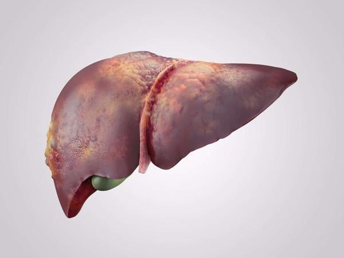 脂肪肝の症状：肝疾患の7つの異常な兆候 - Nipponese