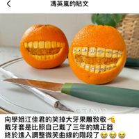 可能是顯示的文字是「馮英嵐的貼文 STAUB 向學姐江佳君的笑掉大牙果雕致敬 戴牙套是比照自己戴了三年的矯正器 終於進入調整微笑曲線的陪段了」的圖像