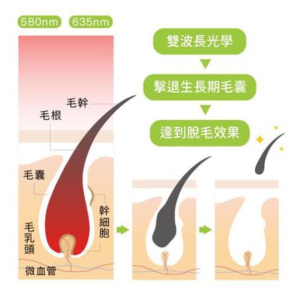 【冰晶除毛雷射】私密處VIO全除