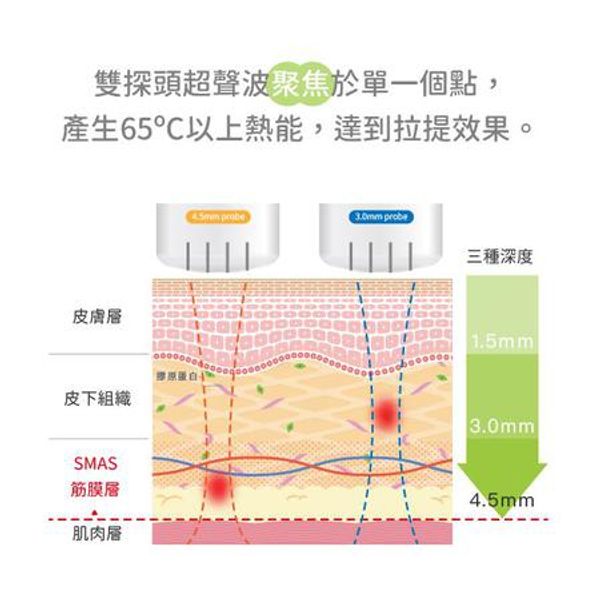 【極線音波拉提】解決鬆垮下垂