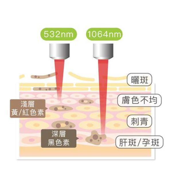 【超秒雷射】斑點OUT!